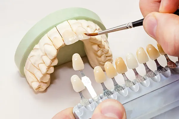 Сфера Дент - зуботехническая лаборатория в Москве